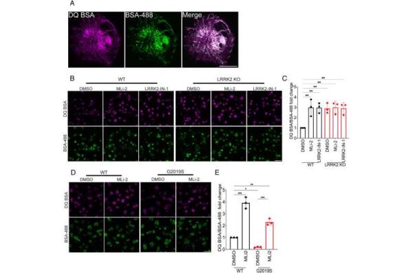 Study reveals insights into l<em></em>ink between genetic mutation and Parkinson's